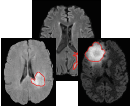 Medical Imaging